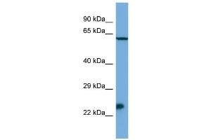 Image no. 1 for anti-Homeobox, Msh-Like 3 (MSX3) (N-Term) antibody (ABIN2779958)