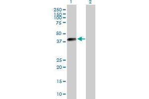 Image no. 1 for anti-delta-Like 2 Homolog (DLK2) (AA 1-383) antibody (ABIN528812)