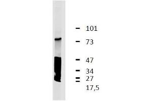 Image no. 1 for anti-Leucine Rich Repeat Containing 32 (LRRC32) antibody (ABIN1981876)