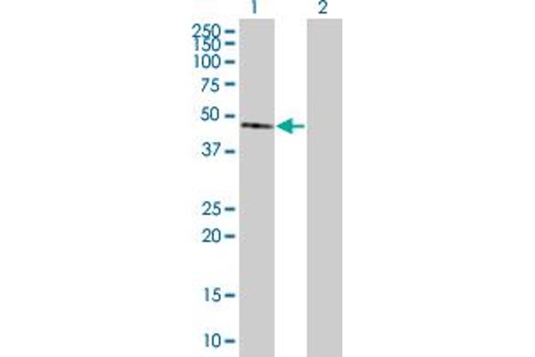 anti-Zinc Finger Protein 92 (ZNF92) (AA 1-517) antibody