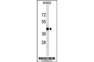 Image no. 1 for anti-Calcium Channel, Voltage-Dependent, gamma Subunit 4 (CACNG4) (AA 147-175) antibody (ABIN656794)