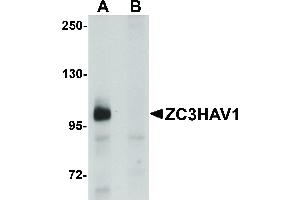 Image no. 1 for anti-Zinc Finger CCCH-Type, Antiviral 1 (ZC3HAV1) (C-Term) antibody (ABIN6655609)