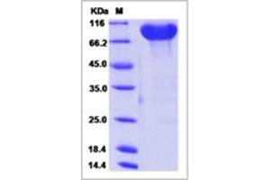 Image no. 1 for Cell Adhesion Molecule 4 (CADM4) (AA 1-323) protein (Fc Tag) (ABIN2693247)