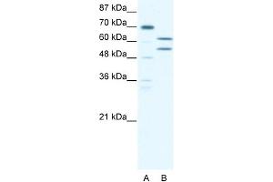 anti-Zinc Finger and BTB Domain Containing 43 (ZBTB43) (N-Term) antibody