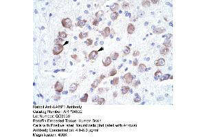 Image no. 1 for anti-La Ribonucleoprotein Domain Family, Member 1B (LARP1B) (Middle Region) antibody (ABIN2775855)