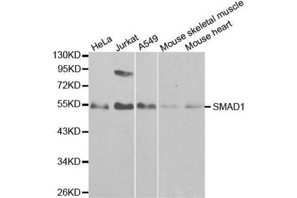 anti-SMAD, Mothers Against DPP Homolog 1 (SMAD1) antibody