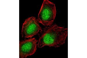 Image no. 4 for anti-delta Like Protein 3 (DLL3) (AA 519-548), (C-Term) antibody (ABIN653276)