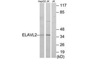 Image no. 1 for anti-ELAV (Embryonic Lethal, Abnormal Vision, Drosophila)-Like 2 (Hu Antigen B) (ELAVL2) (AA 11-60) antibody (ABIN1533851)