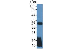 Image no. 5 for Transmembrane Protein 27 (TMEM27) ELISA Kit (ABIN6720600)
