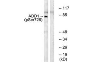 Western blot analysis of extracts from HeLa cells treated with Forskolin 40nM 30', using ADD1 (Phospho-Ser726) Antibody.