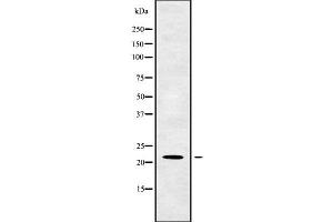 Image no. 1 for anti-TM2 Domain Containing 1 (TM2D1) (Internal Region) antibody (ABIN6265608)