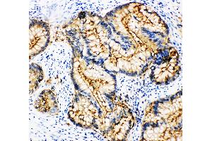 Image no. 1 for anti-Carcinoembryonic Antigen-Related Cell Adhesion Molecule 1 (Biliary Glycoprotein) (CEACAM1) antibody (ABIN3043635)