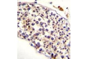 Image no. 1 for anti-HAUS Augmin-Like Complex, Subunit 3 (HAUS3) (AA 379-408), (Middle Region) antibody (ABIN952682)