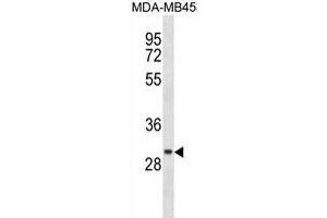 CCDC24 Antibody (N-term) (ABIN1538860 and ABIN2849823) western blot analysis in MDA-M cell line lysates (35 μg/lane).