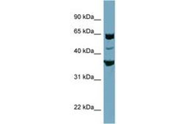 SEC22C anticorps  (AA 179-228)
