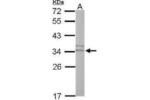 Image no. 2 for anti-phospholipid Scramblase 3 (PLSCR3) (Center) antibody (ABIN2855250)