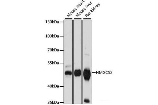 HMGCS2 抗体
