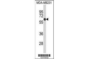 Image no. 1 for anti-Ankyrin Repeat Domain 13C (ANKRD13C) (AA 1-30), (N-Term) antibody (ABIN653090)