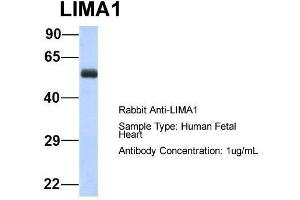 Image no. 1 for anti-LIM Domain and Actin Binding 1 (LIMA1) (N-Term) antibody (ABIN2776038)