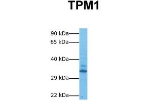 Image no. 4 for anti-Tropomyosin 1 (Alpha) (TPM1) (N-Term) antibody (ABIN2776783)