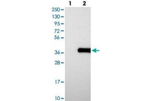 Image no. 2 for anti-Pseudouridylate Synthase-Like 1 (PUSL1) antibody (ABIN5586609)