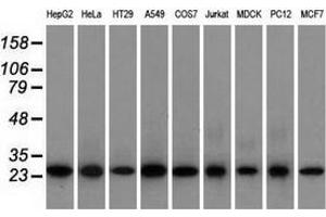 Image no. 3 for anti-EMG1 Nucleolar Protein Homolog (EMG1) antibody (ABIN2720156)