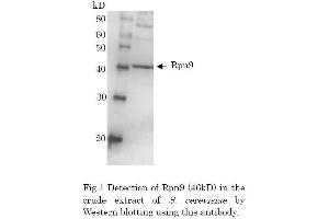 Image no. 2 for anti-Proteasome (Prosome, Macropain) 26S Subunit, Non-ATPase, 13 (PSMD13) (full length) antibody (ABIN2452116)