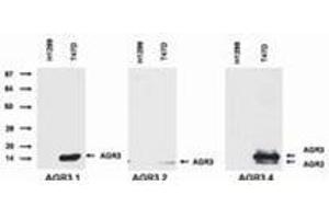 Image no. 2 for anti-Anterior Gradient 3 (AGR3) antibody (ABIN614770)