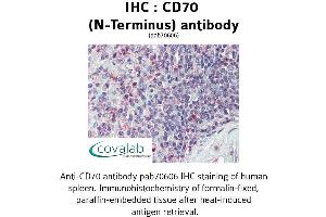 Image no. 2 for anti-CD70 Molecule (CD70) (N-Term) antibody (ABIN1732877)