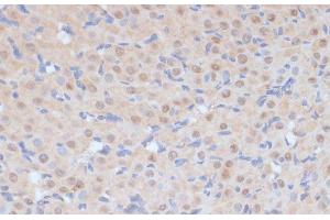 Immunohistochemistry of paraffin-embedded Rat ovary using CDK9 Polyclonal Antibody at dilution of 1:100 (40x lens).