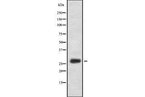 Image no. 1 for anti-Family with Sequence Similarity 58, Member A (FAM58A) (Internal Region) antibody (ABIN6256826)