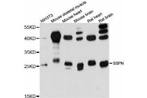 Image no. 1 for anti-Sarcospan (Kras Oncogene-Associated Gene) (SSPN) antibody (ABIN6293742)