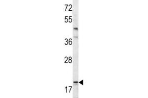Image no. 5 for anti-BCL2-Associated Agonist of Cell Death (BAD) (AA 92-127) antibody (ABIN3030135)