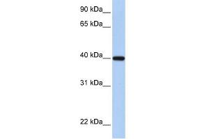 anti-Retinol Dehydrogenase 11 (All-Trans/9-Cis/11-Cis) (RDH11) (C-Term) antibody