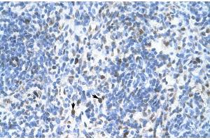 Image no. 6 for anti-Proliferating Cell Nuclear Antigen (PCNA) (C-Term) antibody (ABIN2792157)
