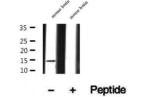 Image no. 2 for anti-SNAP-Associated Protein (SNAPIN) (N-Term) antibody (ABIN6265206)