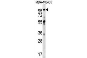 Image no. 2 for anti-Melanoma Inhibitory Activity Protein 2 (MIA2) (AA 774-804), (C-Term) antibody (ABIN951720)