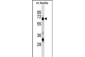 ASNS Antibody (N-term) (ABIN1538985 and ABIN2848593) western blot analysis in mouse testis tissue lysates (35 μg/lane).