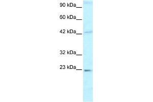 Image no. 1 for anti-High Mobility Group Box 2 (HMGB2) (C-Term) antibody (ABIN2777510)