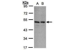 WB Image Sample(30 ug whole cell lysate) A:A431, B:H1299 10% SDS PAGE antibody diluted at 1:1000