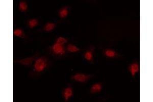 ABIN6274228 staining COLO205 cells by IF/ICC.