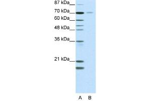 Image no. 2 for anti-Nuclear Receptor Subfamily 2, Group C, Member 1 (NR2C1) (C-Term) antibody (ABIN2792596)