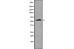 Image no. 1 for anti-Neuropilin (NRP) and Tolloid (TLL)-Like 2 (NETO2) (C-Term) antibody (ABIN6263602)