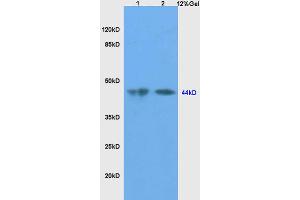 Image no. 1 for anti-Sex Hormone Binding Globulin (SHBG) (AA 301-402) antibody (ABIN738771)
