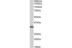 Image no. 2 for anti-Microtubule-Associated Protein, RP/EB Family, Member 3 (MAPRE3) (Internal Region) antibody (ABIN571110)