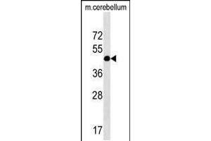 Image no. 1 for anti-RCD1 Required For Cell Differentiation1 Homolog (RQCD1) (AA 106-134) antibody (ABIN5538563)