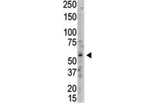 PRMT3 antibody  (AA 460-491)