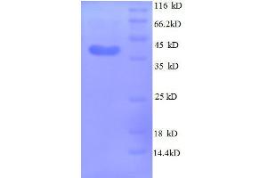 Image no. 1 for Midkine (Neurite Growth-Promoting Factor 2) (MDK) (AA 21-143), (full length) protein (GST tag) (ABIN1047388)