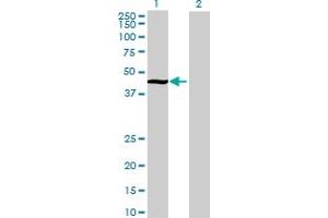 Image no. 1 for anti-tRNA Methyltransferase 11 Homolog (Trmt11) (AA 1-463) antibody (ABIN528433)