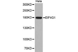 Western Blotting (WB) image for anti-Eukaryotic Translation Initiation Factor 4 Gamma, 1 (EIF4G1) antibody (ABIN1512859)